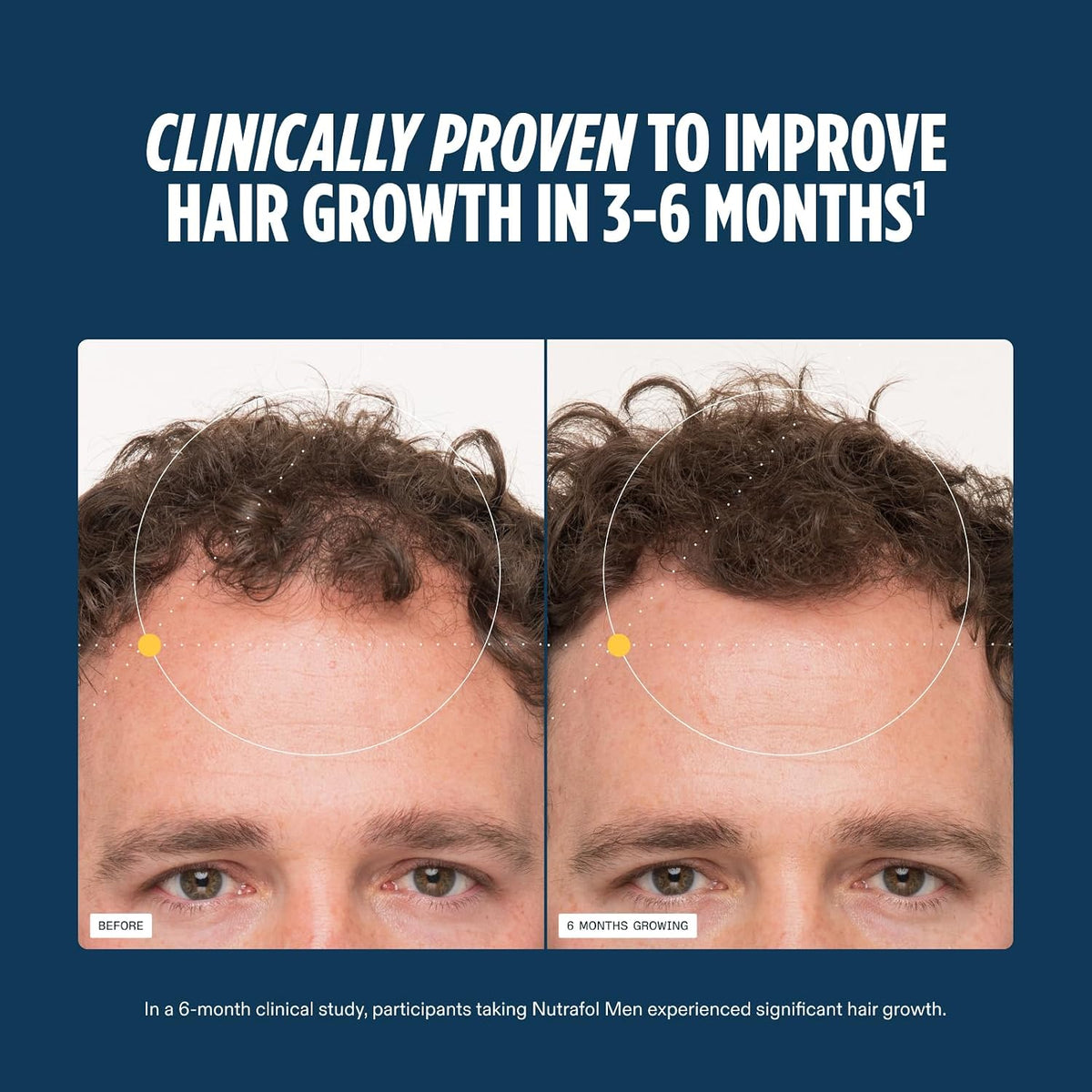 Nutrafol Men Hair Growth Supplements
